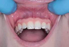 What Is Total Health in Dentistry