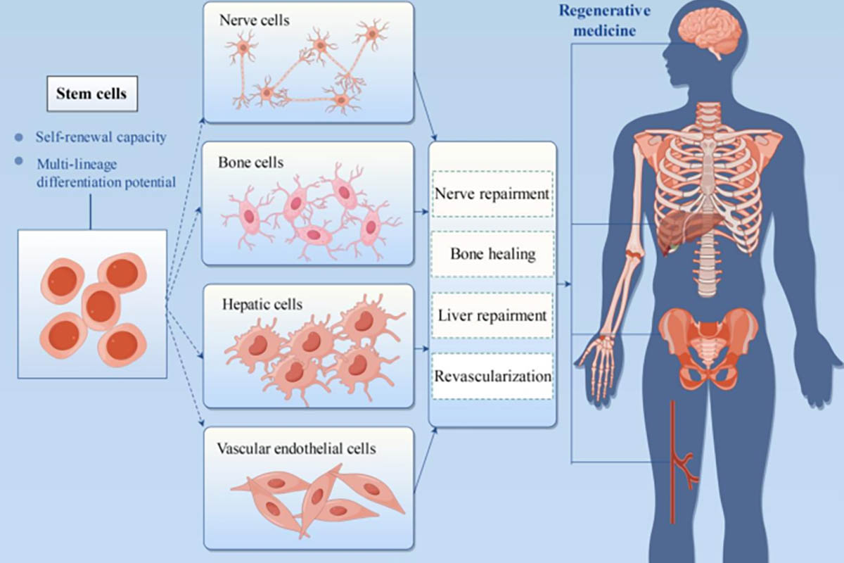 What’s Involved in a Stem Cell Treatment?