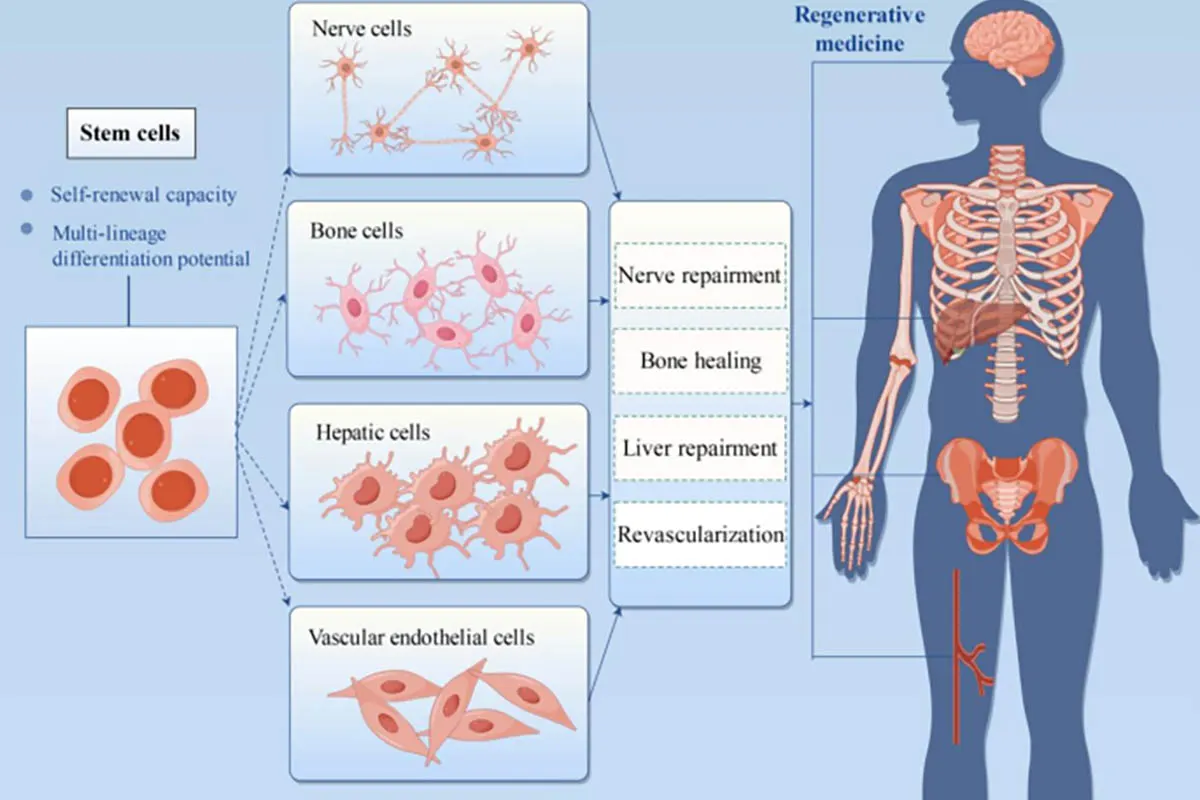 What’s Involved in a Stem Cell Treatment?